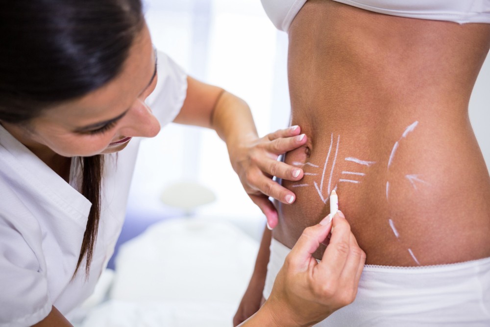 Liposuction Treatment Delhi